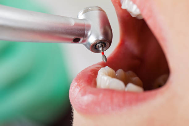 Best Emergency Broken Tooth Repair in Jackson, TN